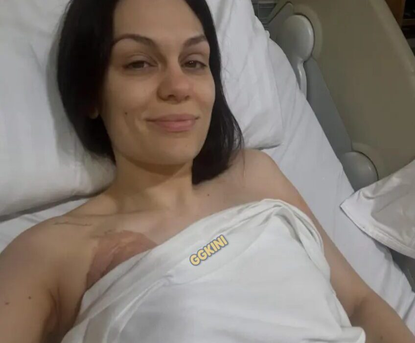女歌手Jessi J接受癌症手术后的封面图，面带坚强表情。